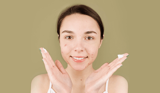 Dive into the Niacinamide Saga: Skin's Mighty Muse - Unraveling the Marvels and Mischief - Neude Skin