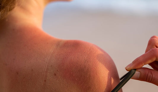 How to Remove Sun Tan from Face and Body: A Complete DeTan Routine