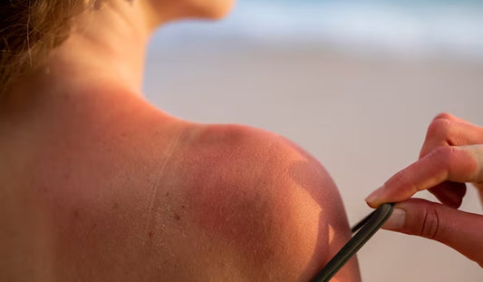 Reverse that Sun Damage Before it Hits Deep, with these Products - Neude Skin
