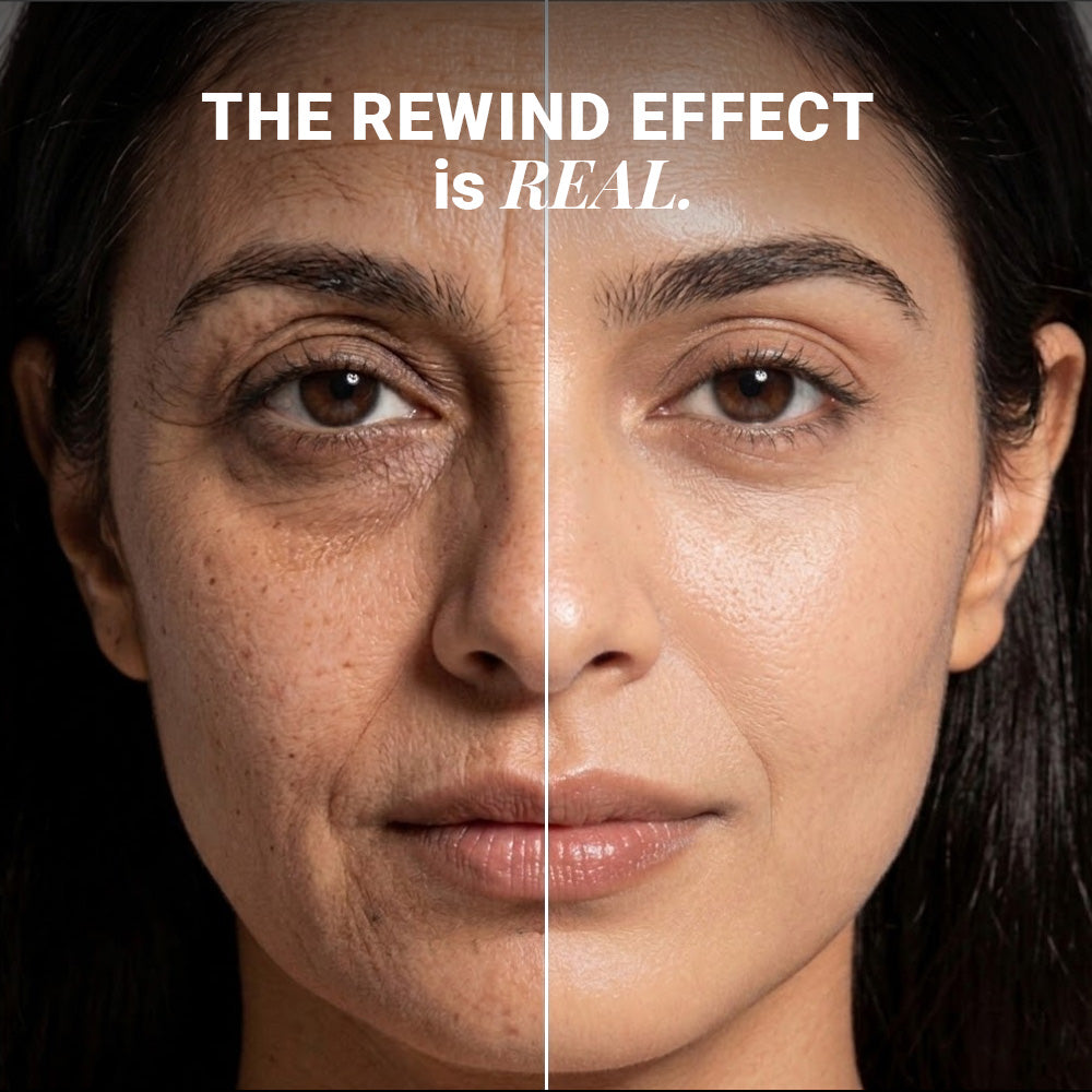 Rewind Age Reversing Gel Crème For Wrinkles and Fine Lines