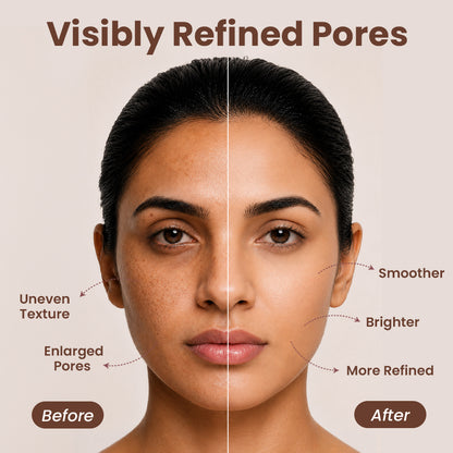 Tone It Up Face Toner for Pore-Corrected, Plump Skin