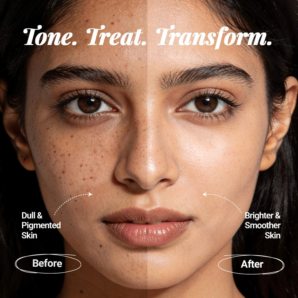 Milk Tonic: Depigmenting & Hydrating Milky Toner with 10% Actives, Camel Milk, Ceramides, Snail Mucin