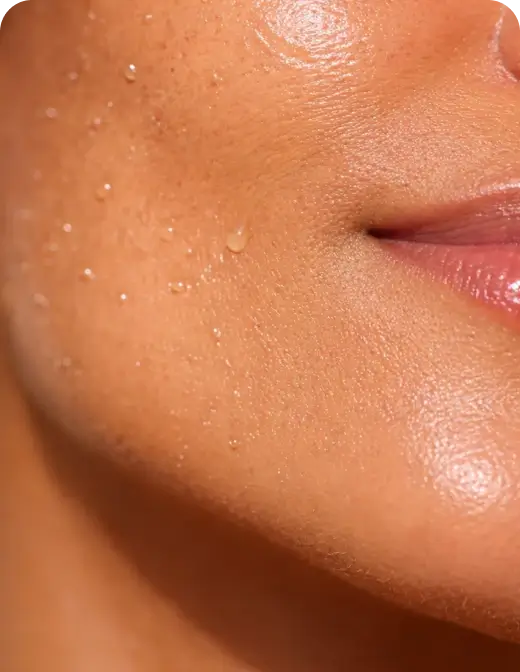 Oily & Congested